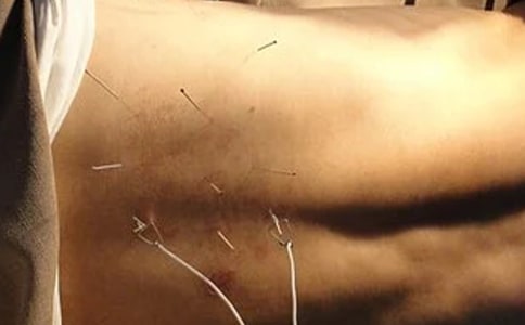针灸科工作总结
